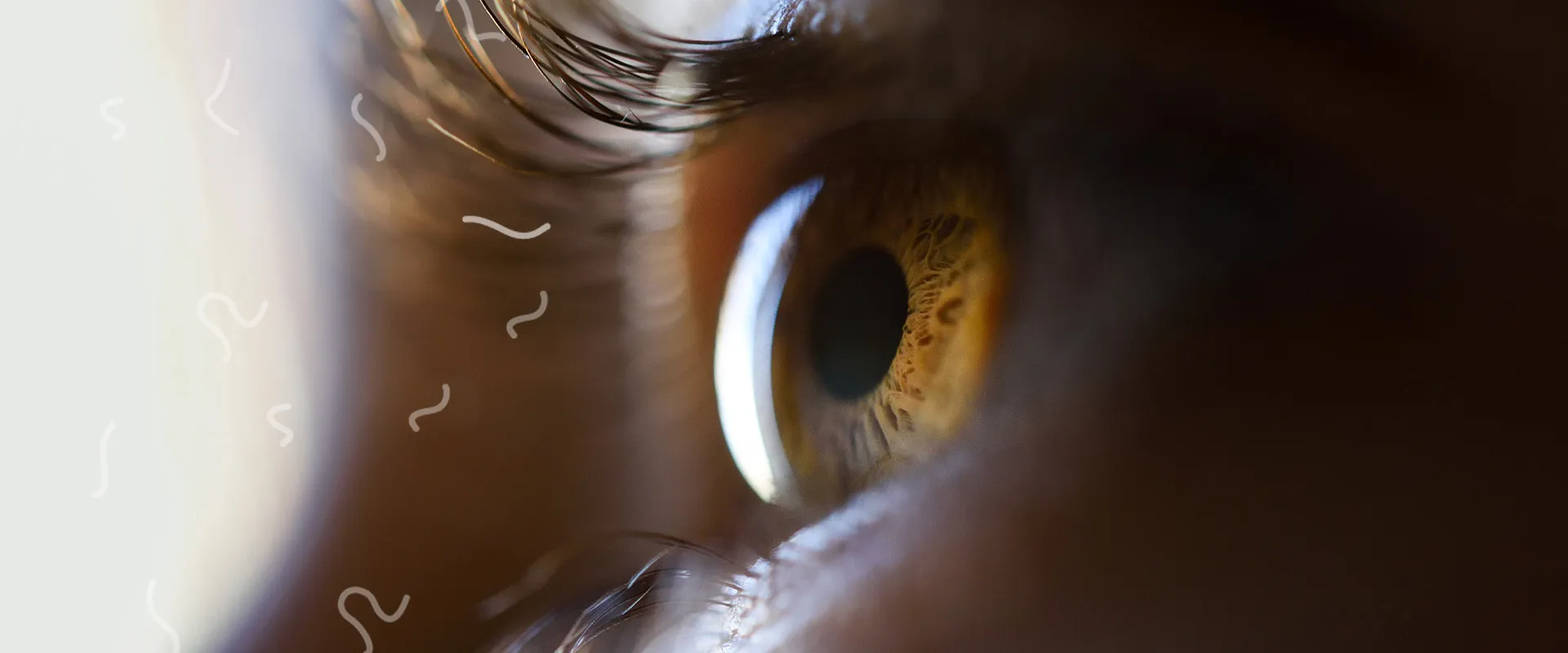 Eye close up with eye floaters